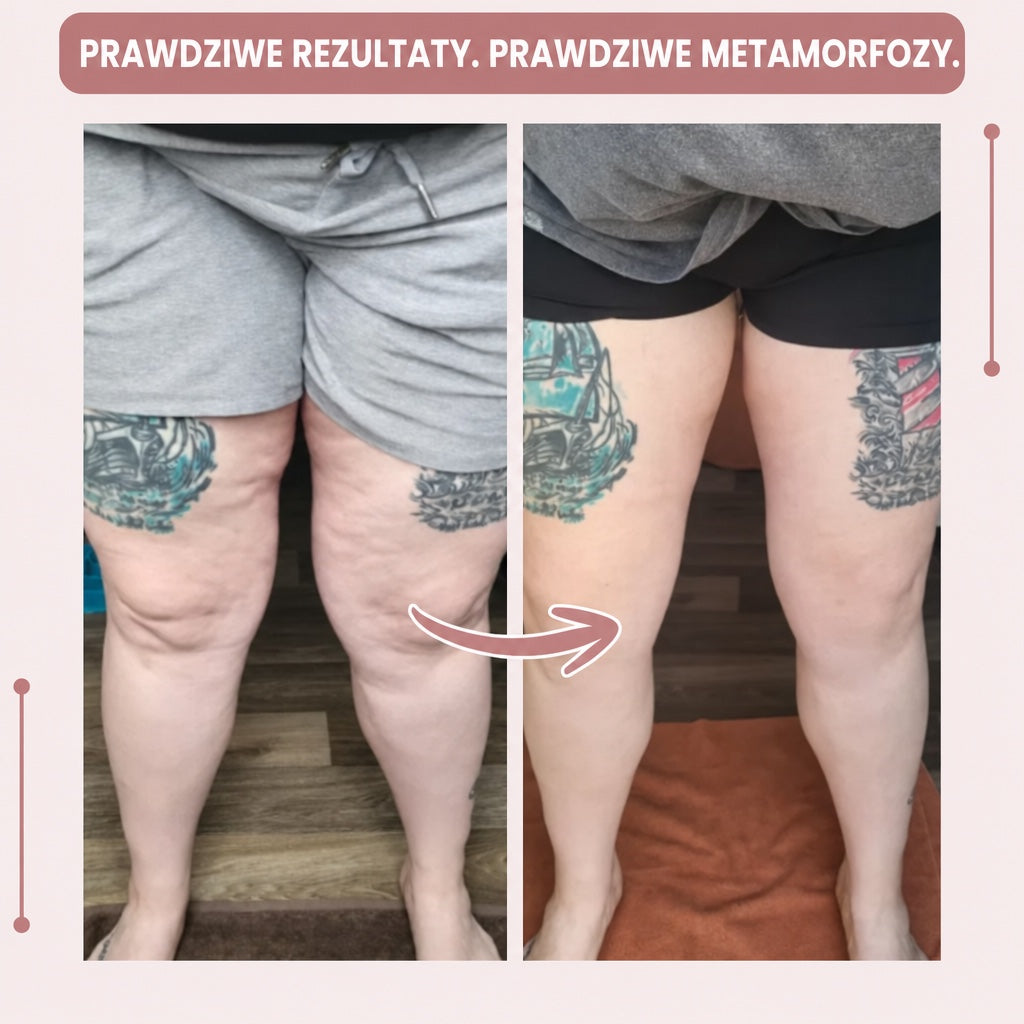 Przed i po — efekty naszych klientek ⭐